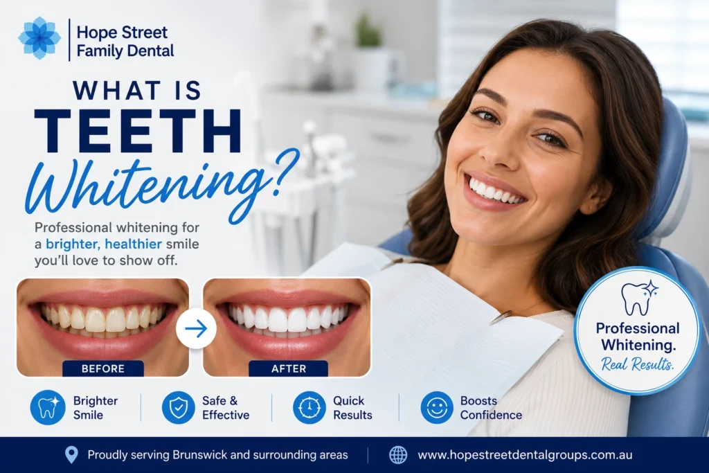 What is Teeth whitening