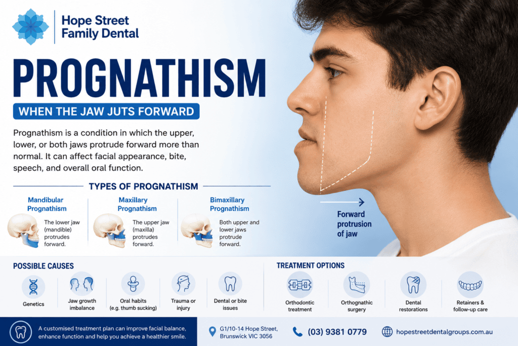 What does prognathism mean